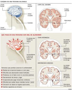 alzheimer info32