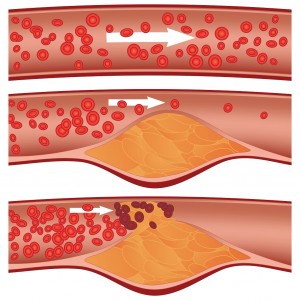 colesterol-2