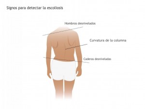 LA ESCOLIOSIS ¿Qué es, qué tipos hay y cómo se trata?